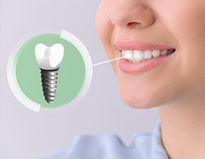 An illustration of a woman s face with a focus on her teeth, featuring an image of a tooth implant with a screw symbolizing dental repair, set against a background that includes a smiling mouth with a missing tooth and a dental implant in a circular inset.